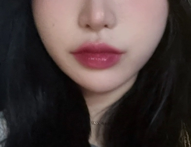 หญิงหลังการทำดีไซน์ฟิลเลอร์เพื่อเพิ่มวอลลุ่ม
