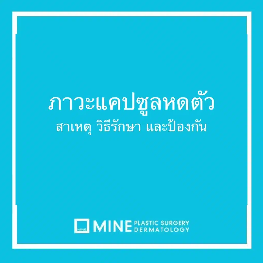 ภาวะแคปซูลหดตัว สาเหตุ วิธีรักษา และป้องกัน