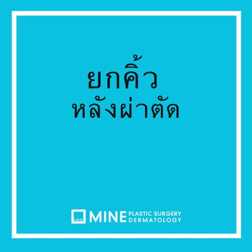 ศัลยกรรมยกคิ้ว หลังผ่าตัด: คู่มือดูแลตัวเอง 9 ข้อจากแพทย์