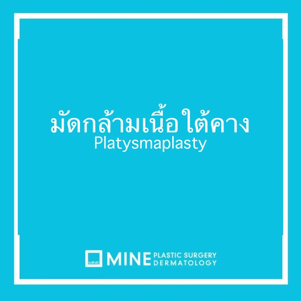 มัดกล้ามเนื้อใต้คาง Platysmaplasty