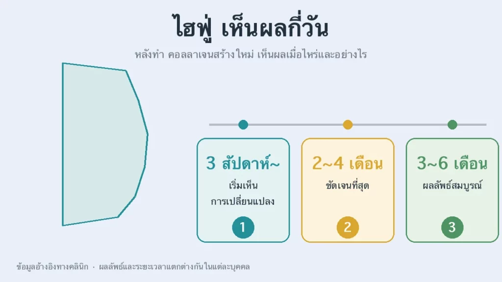 ไฮฟู่ เห็นผลกี่วัน — ไทม์ไลน์ผลลัพธ์ HIFU 3 สัปดาห์ ถึง 6 เดือน