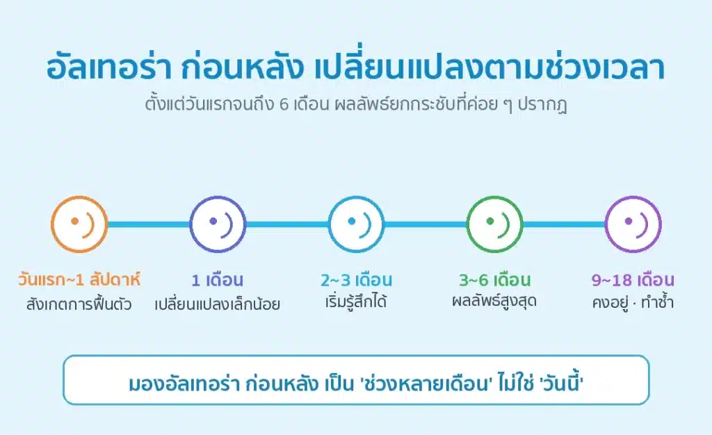อัลเทอร่า ก่อนหลัง ไทม์ไลน์การเปลี่ยนแปลงตั้งแต่วันแรกจนถึง 6 เดือน อินโฟกราฟิกโดยโรงพยาบาลศัลยกรรมมาอิน